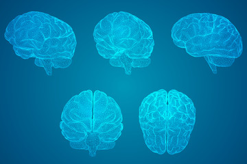 汽车常见的故障有哪些